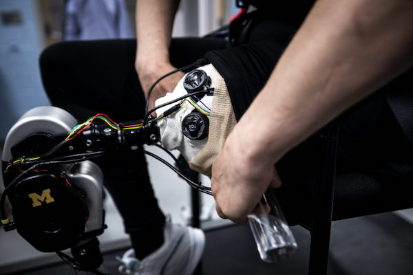 Open Source Bionic Leg: First-of-its-kind Platform Aims To Rapidly ...